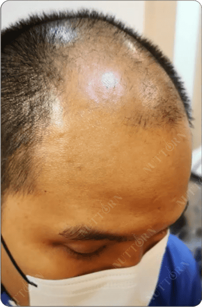 Home page Before and After Slider