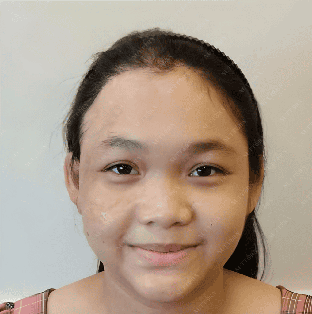 Patient Spotlight After Photo