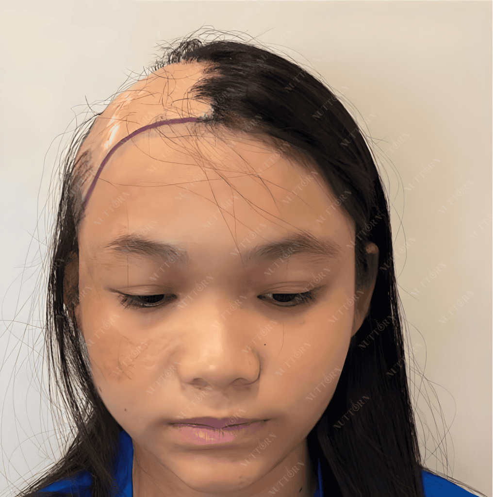 Patient Spotlight Before Photo