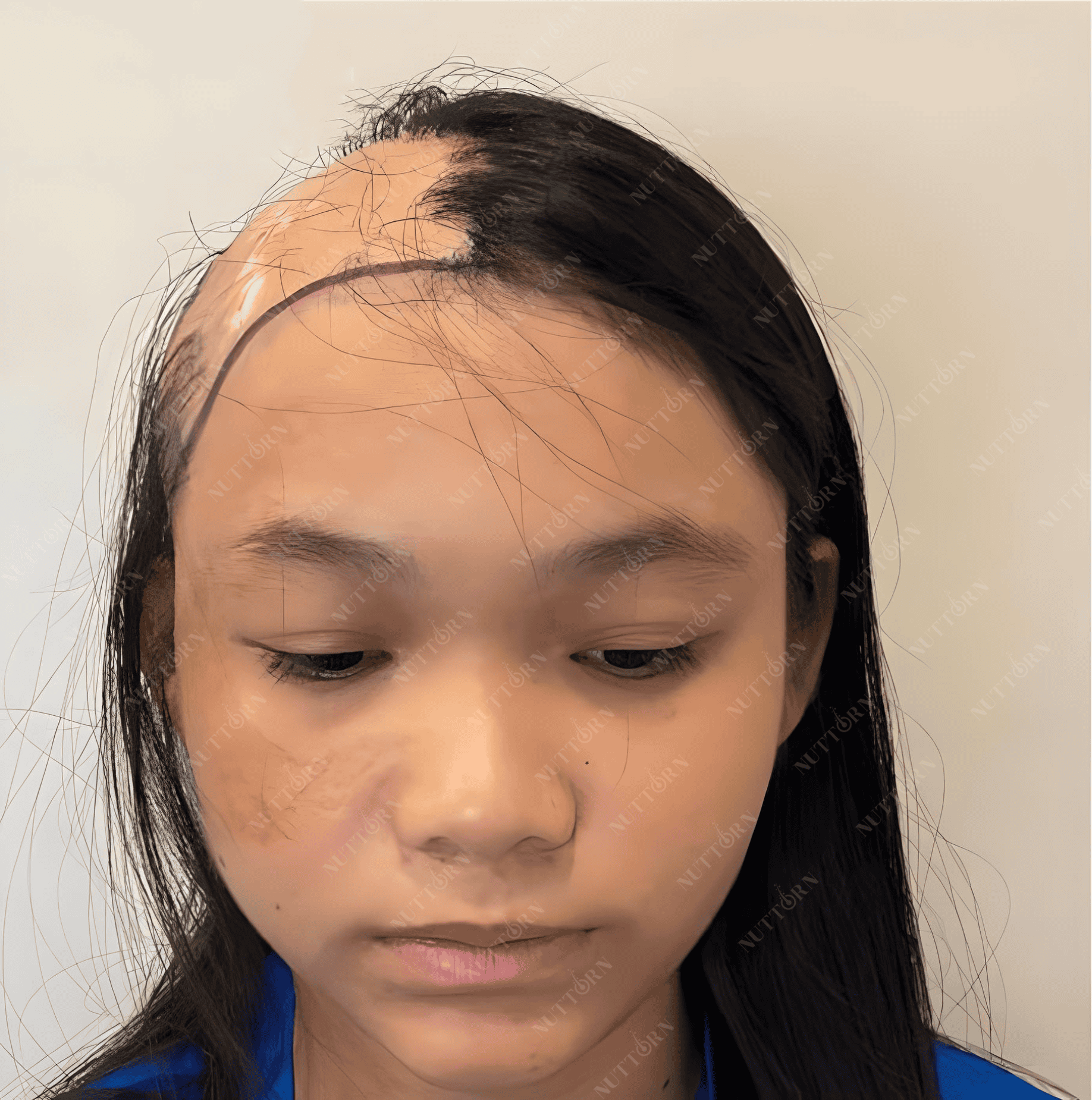 Patient Spotlight Before Photo