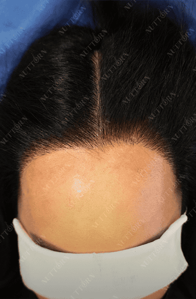 Home page Before and After Slider