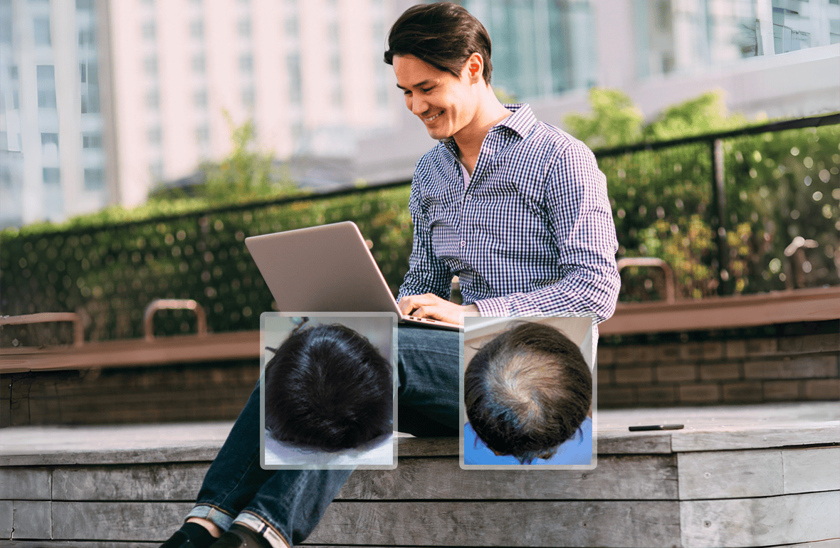 ALMI Nanofat Example