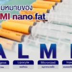 ALMI Nanofat Transfer