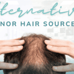 Alternative donor hair sources for FUE/DHI hair transplants from chest, beard, back, and leg hair.