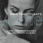 Long Hair Transplants: The Ideal Solution For Women Suffering Hair Loss