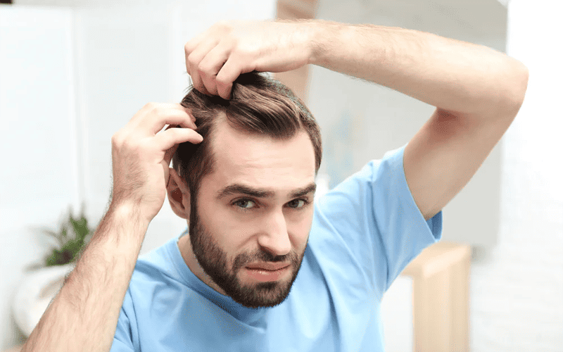 Male scalp with thinning hair, hair restoration, hair loss kezelÃ©s, hair growth treatment.