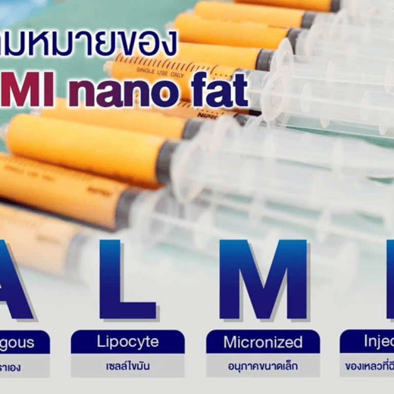 ALMI Nanofat Transfer