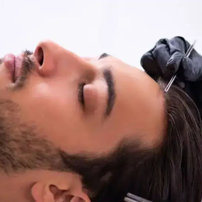 Expert hair transplant for natural hair restoration at Nuttorn Hair Centre. Book your consultation today.