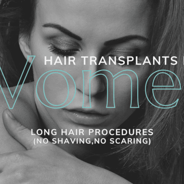 Long Hair Transplants: The Ideal Solution For Women Suffering Hair Loss