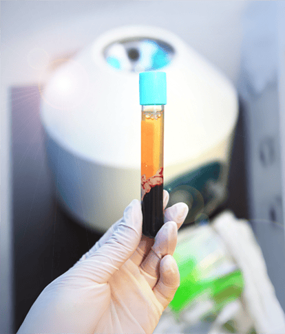 Exosome Rich Plasma (ERP) image