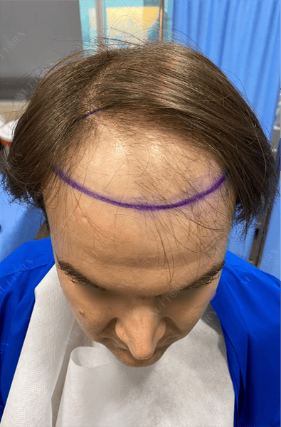 Home page Before and After Slider