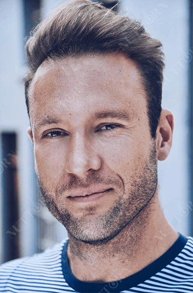 Home page before and after slider