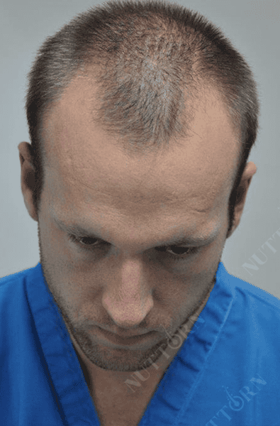 Home Page before and after slider